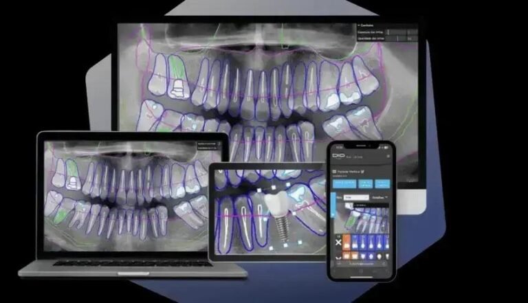 Startups brasileiras estão transformando a realidade com Inteligência Artificial